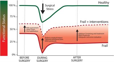 The frail patient undergoing cardiac surgery: lessons learned and future perspectives